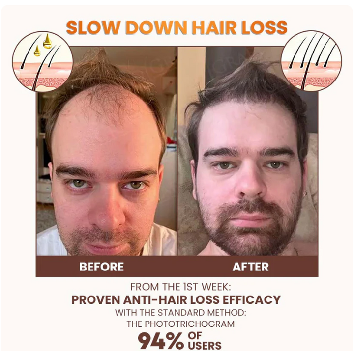 Premium Biotin Hair&Beard Booster