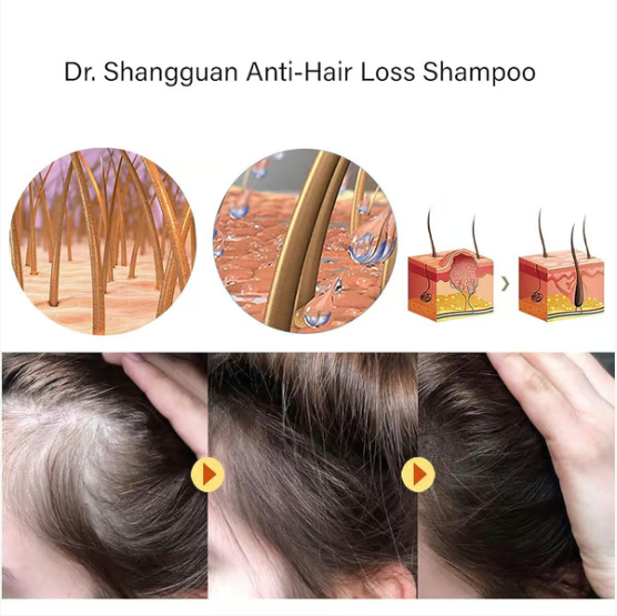 Dr. Shangguan Anti-Hair Loss Shampoo