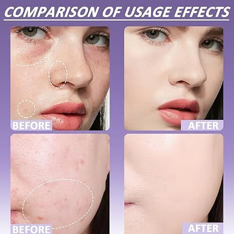 🎁Soft Matte Cream Concealer