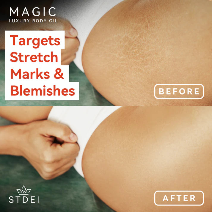 MAGIC LUXURY BODY OIL