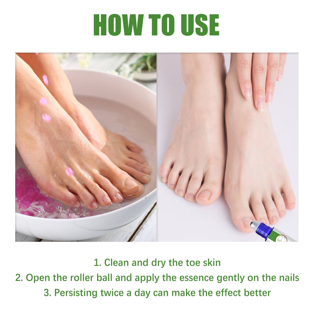 (Anti Fungal Stick) Say Goodbye to Nail Fungus in Just 5 Days!