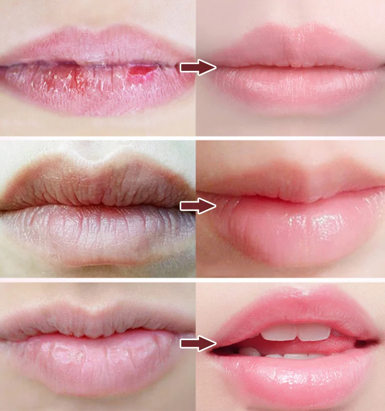 Moisturizing color changing dual-color lip mask