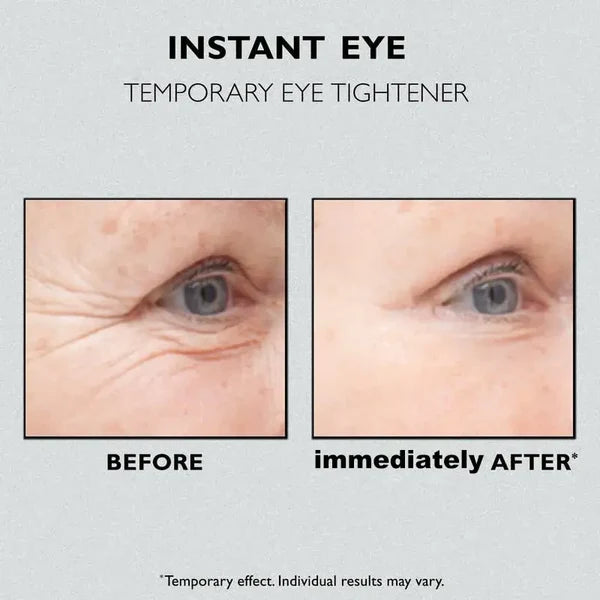 (✨Buy 2 Get 1 Free💕) Instant Wrinkle Eye Tightener cream🔥Last Day Sale 50% OFF🔥