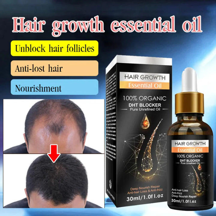 2024 NEW HAIR GROWTH ESSENTIAL OIL