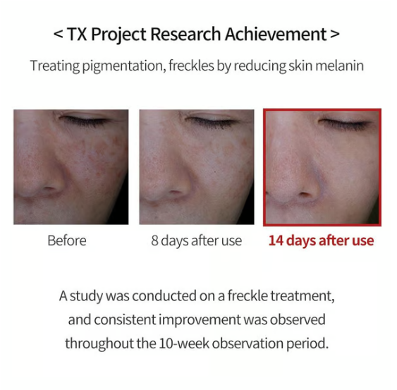 TX Cream -for Dark Spots & Hyperpigmentation