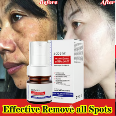 Vitamin C Whitening Freckles Face Cream Remove Melasma Dark Spots Lighten Melanin