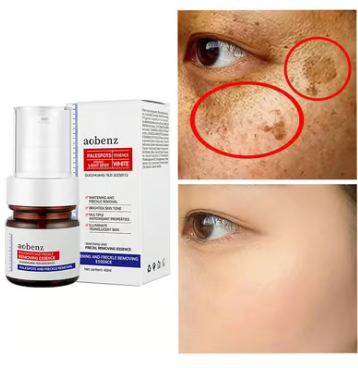 Vitamin C Whitening Freckles Face Cream Remove Melasma Dark Spots Lighten Melanin