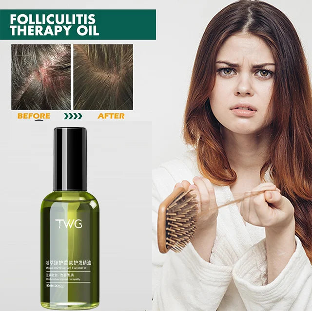 2024 Scalp hair care anti-itch repair essentialoil