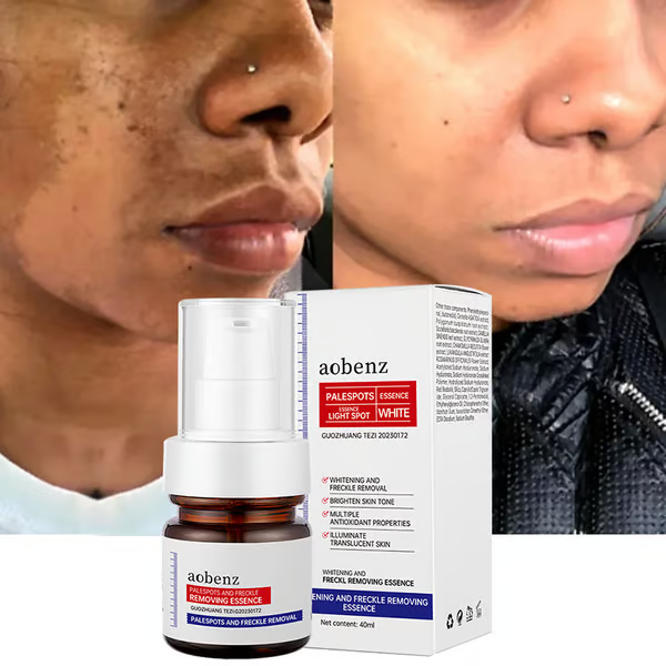 🔥Vitamin C Whitening Freckles Face Cream Remove Melasma Dark Spots Lighten Melanin