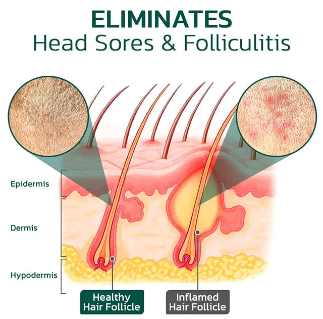 2024 Scalp hair care anti-itch repair essentialoil