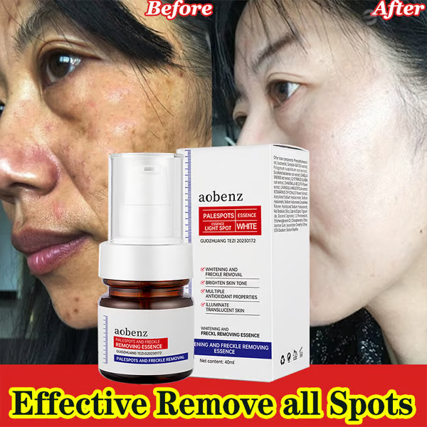 🔥Vitamin C Whitening Freckles Face Cream Remove Melasma Dark Spots Lighten Melanin