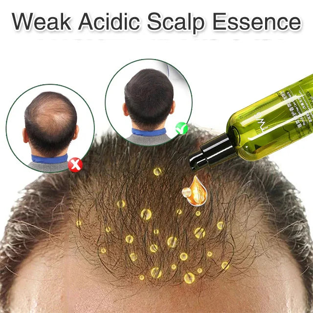 2024 Scalp hair care anti-itch repair essentialoil