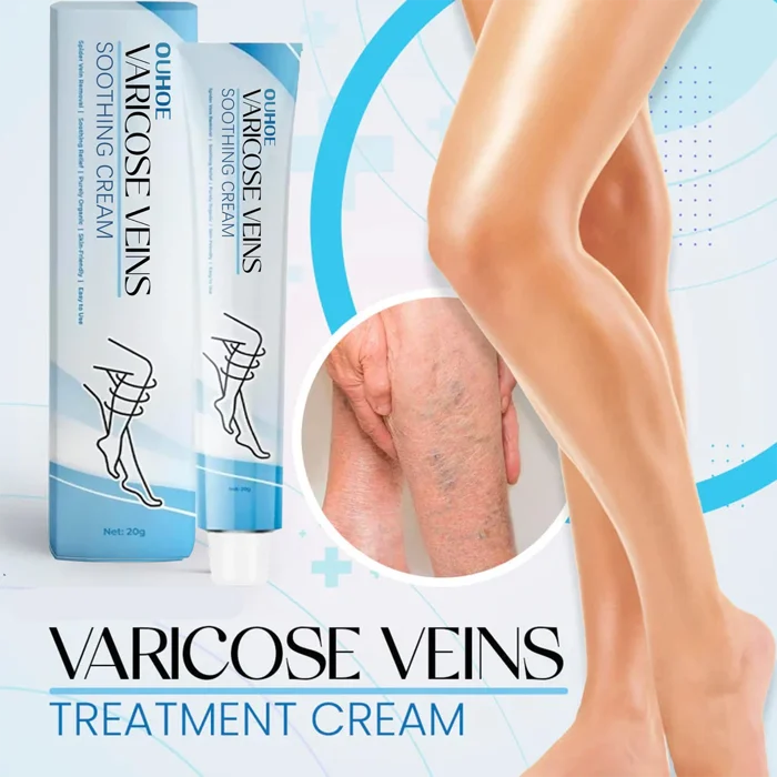 💥2024 Experts Recommend Product-Varicose Veins Treatment Cream