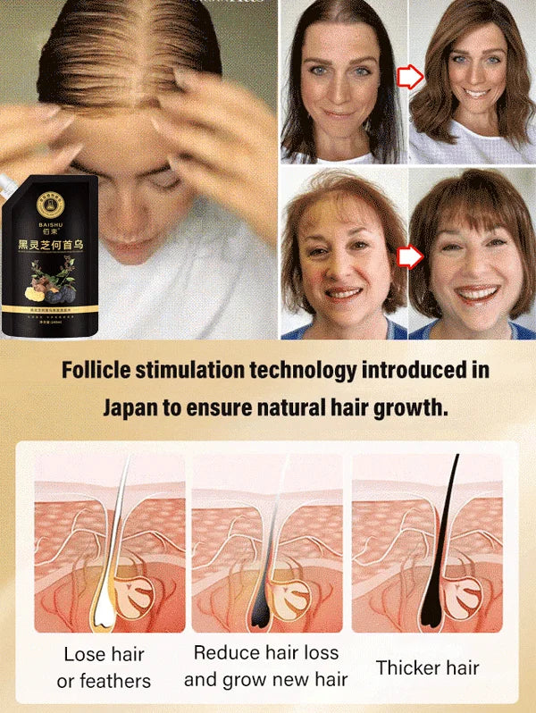 Anti-hair loss and hair growth shampoo