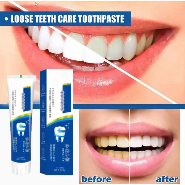 🔥🔥🔥Buy 2 Get 1 Free(Hot Sale)-Repair Toothpaste