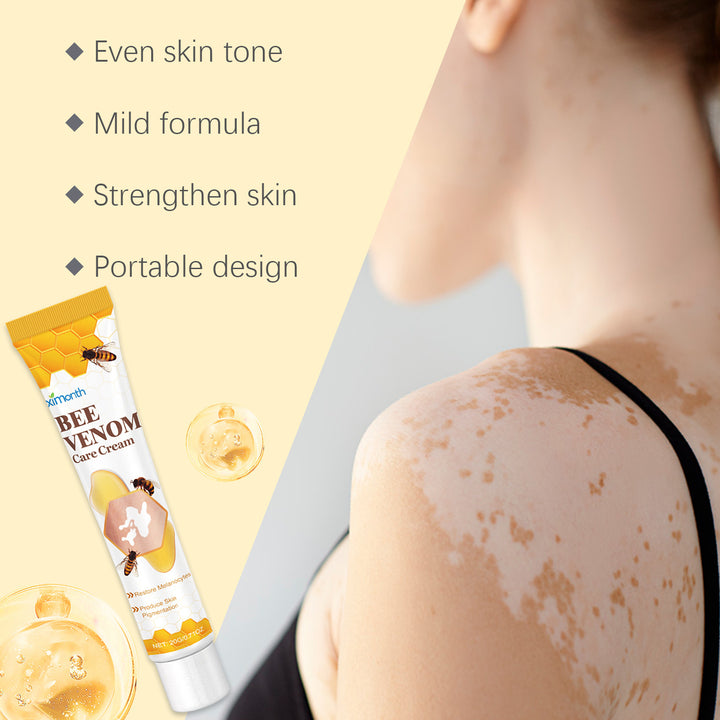 BeeVenom Vitiligo Treatment Cream