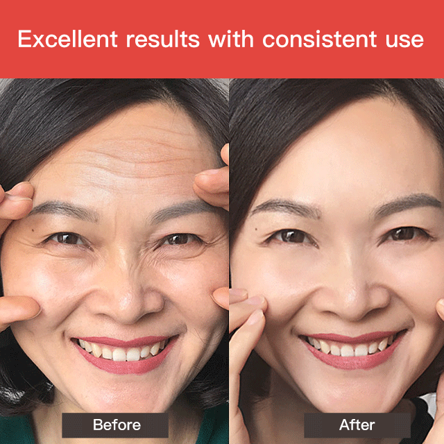 [For Sensitive Skin] Lifting and Anti-Wrinkle Serum