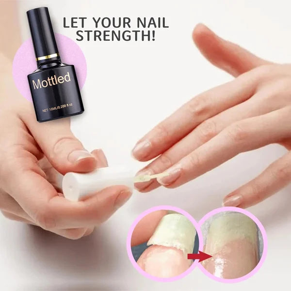 🔥Summer Hot Sale-48% OFF-2023 NAIL REPAIR PROTECTION GEL