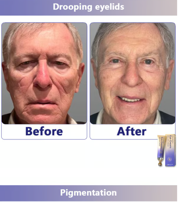 Collagen+Ball eye cream Roll-on