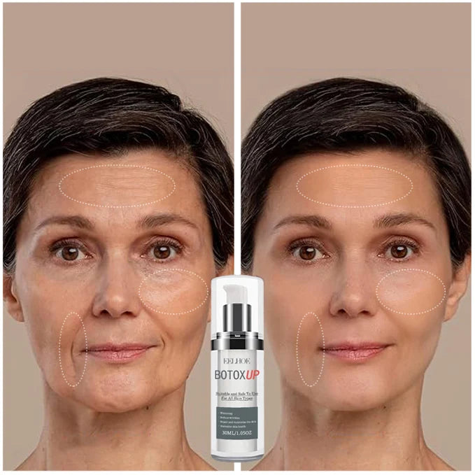 Botox Anti-Aging Serum