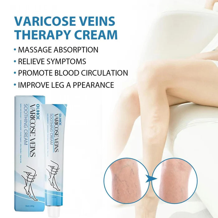 💥2024 Experts Recommend Product-Varicose Veins Treatment Cream