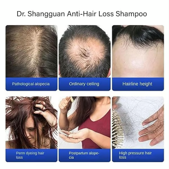 Dr. Shangguan Anti-Hair Loss Shampoo