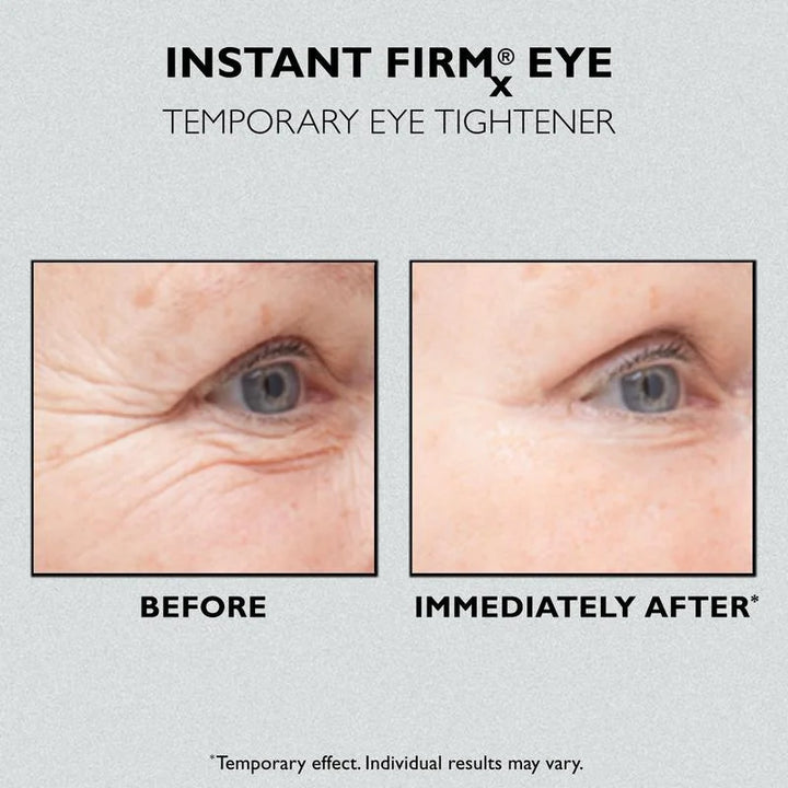 🔥Last Day 49% OFF🎁Instant FIRMx Eye Temporary Eye Tightener