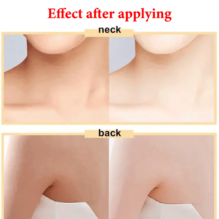 2024 Body Whitening Cream