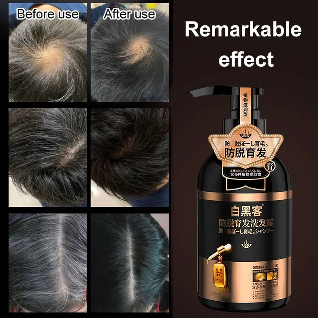 Anti-hair loss shampoo