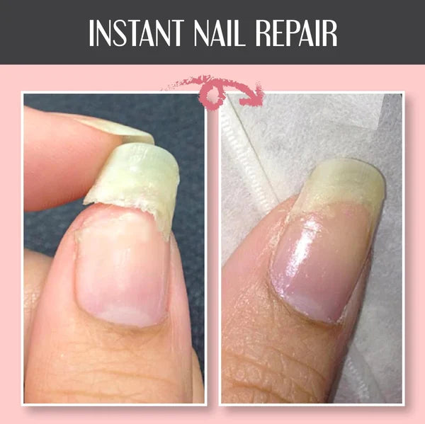 🔥Summer Hot Sale-48% OFF-2023 NAIL REPAIR PROTECTION GEL