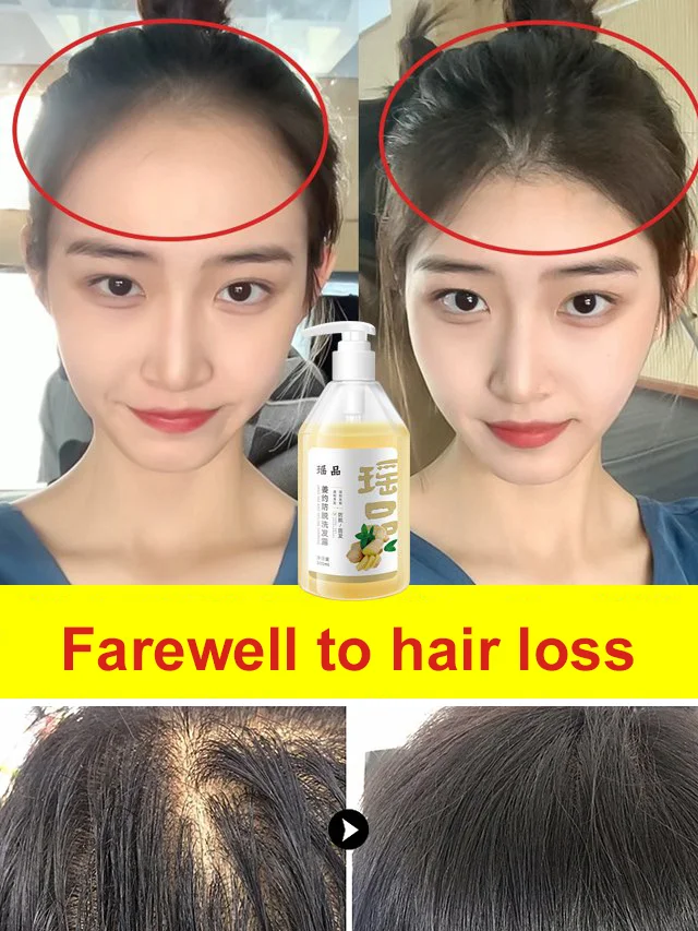 smooth and oil control Anti Hair Loss Shampoo