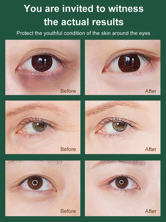Mint essence lightens fine lines and moisturizes eye roller cream