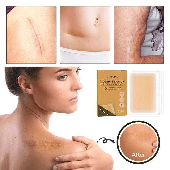 Skin Invisible Concealer ( Patch SCAR COVERIN GTATTOO COVERING )