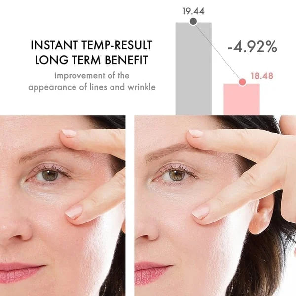 🔥Last Day Promotion 69% OFF🔥❤Anti-Aging Serum