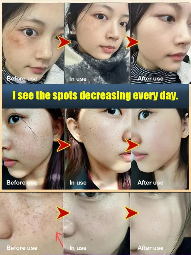 WHITENING AND SPOT-REMOVING CREAM