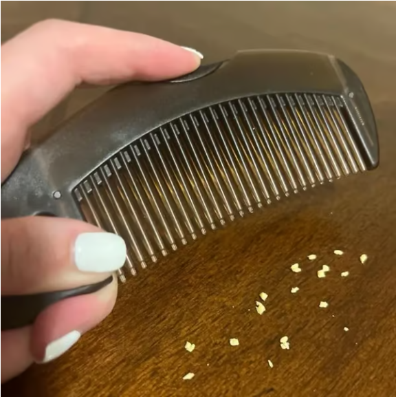 Scalp Sweeping Comb - Efficiently Captures Dandruff and Impurities