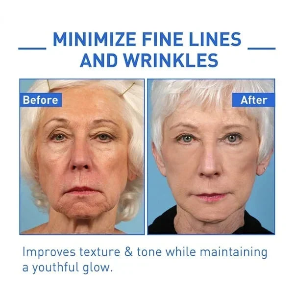 Botox Anti-Aging Serum