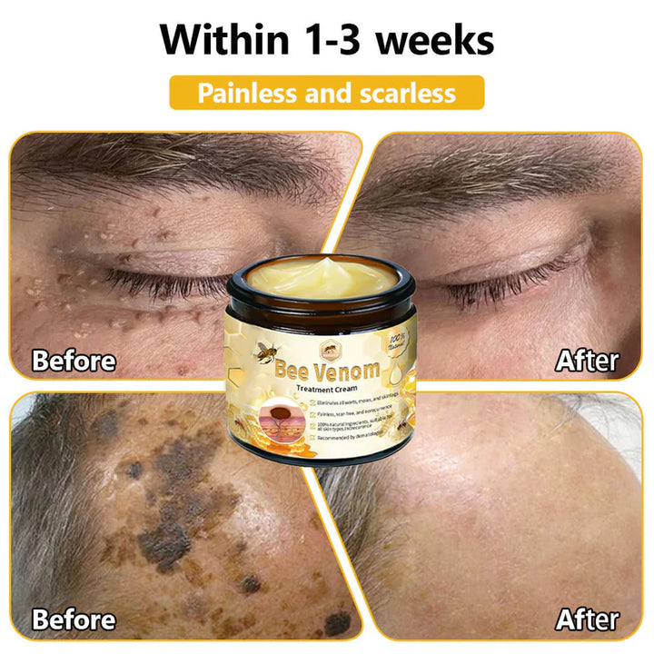 Bee Venom Skin Treatment Cream