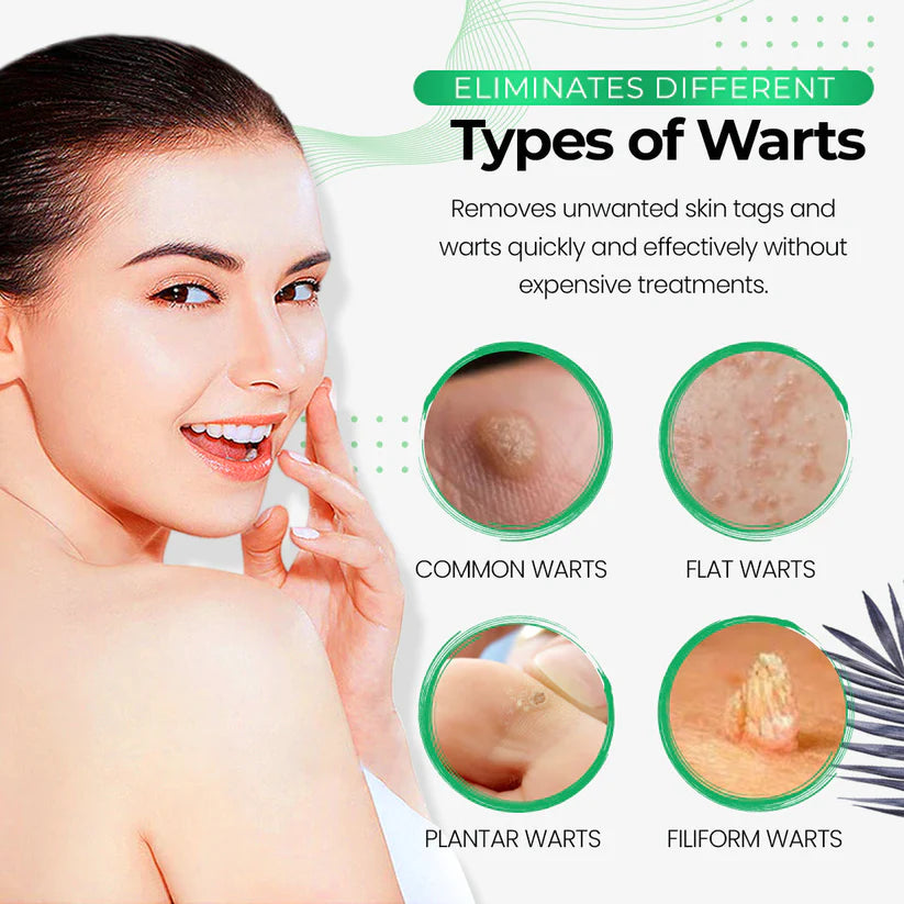 Wart Eliminator Soap