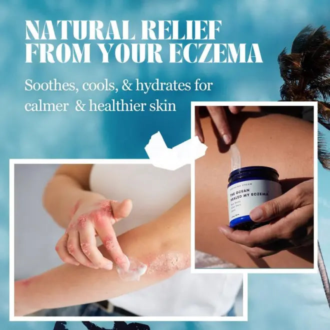 ✨This Weeks Special Price $19.99💥All Natural Eczema Soothing Cream