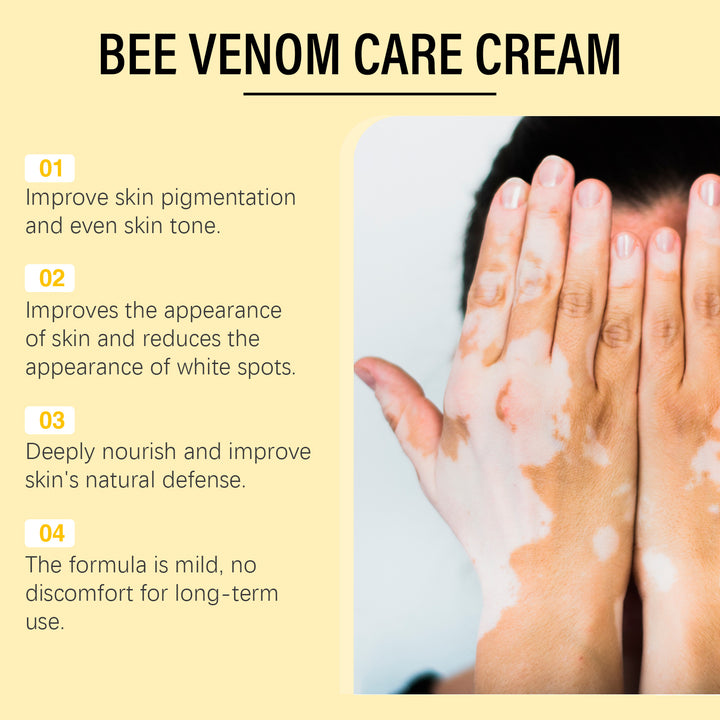 BeeVenom Vitiligo Treatment Cream