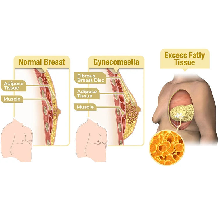 MENTHERM BEE VENOM GYNECOMASTIA HEATING OIL