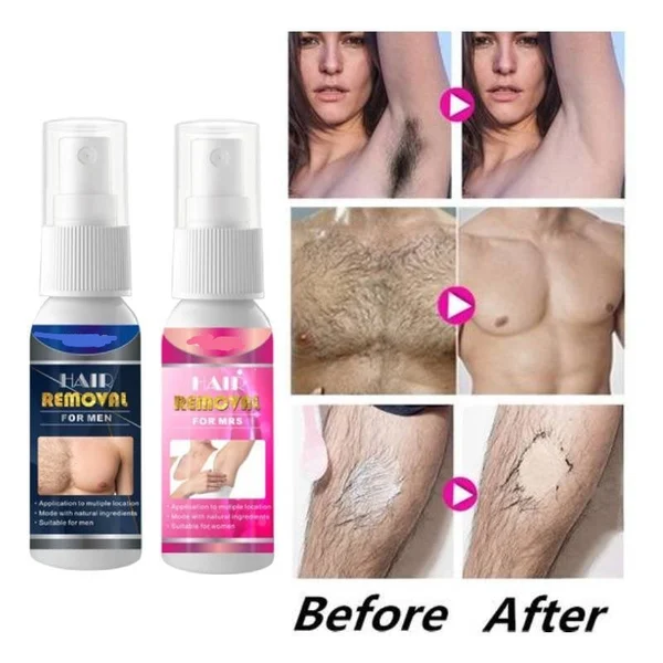 🔥BIG SALE - HALF PRICE🔥🔥Body Hair Removal Spray