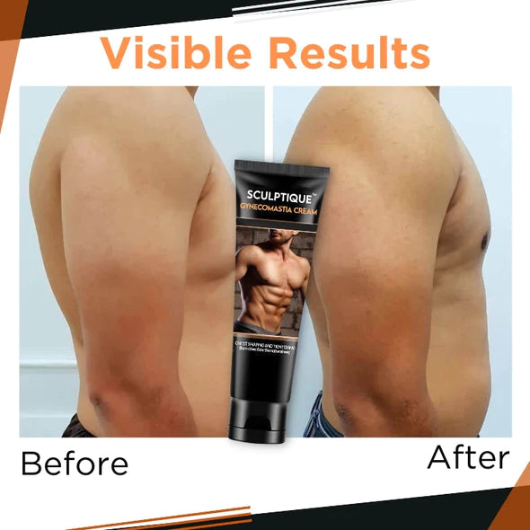 CC™ Gynecomastia Cream