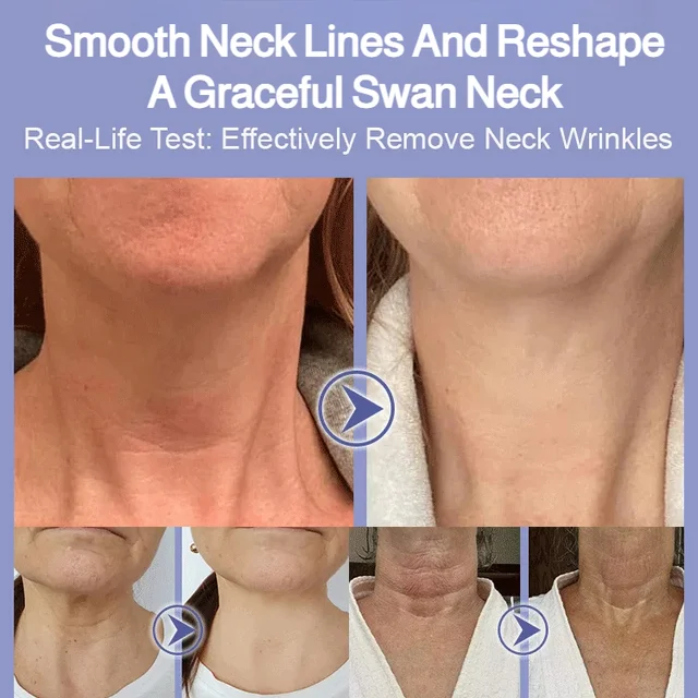 Moisturizing Neck Care Cream