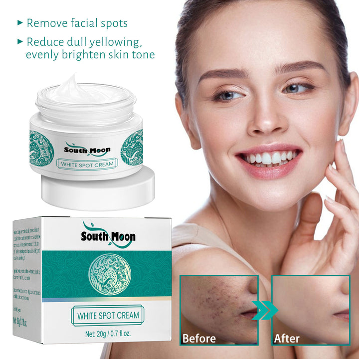 South Moon Whitening and Freckle-Removing Cream