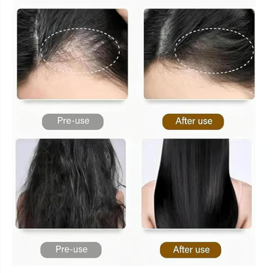 Dr. Shangguan Anti-Hair Loss Shampoo