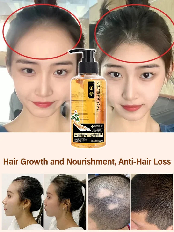 GINSENG HAIR GROWTH THICKENING HAIR