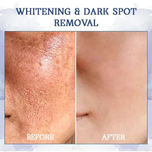 Advanced Firming & Wrinkle-Reducing Cream (Restore Skin Elasticity)