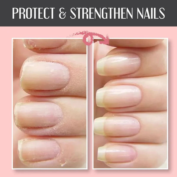 🔥Summer Hot Sale-48% OFF-2023 NAIL REPAIR PROTECTION GEL